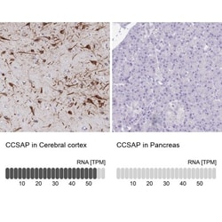 CSAP Antibody, Novus Biologicals:Antibodies:Primary Antibodies
